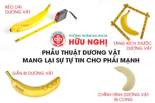 chi phí phẫu thuật dương vật