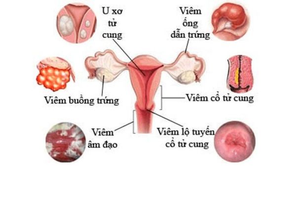 cac-nguyen-nhan-gay-cham-kinh-02