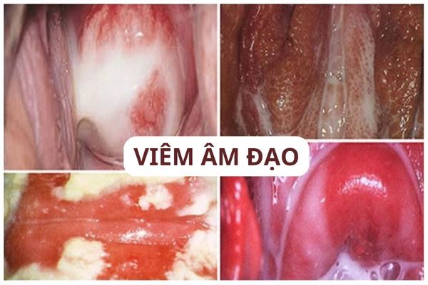 cham-kinh-co-nguy-hiem-khong-02