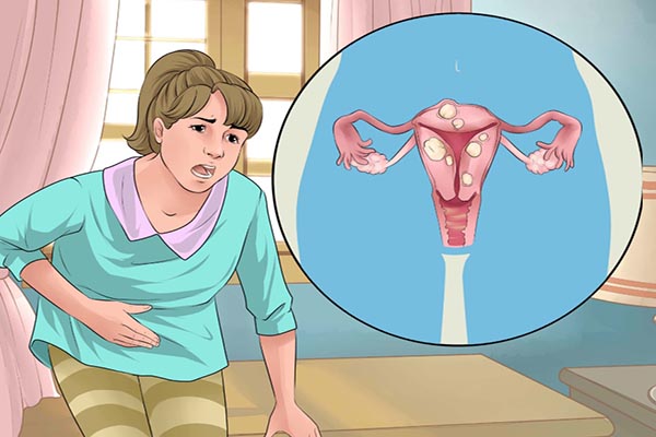 Trễ kinh là triệu chứng của bệnh gì?