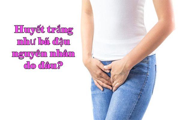 Huyết trắng như bã đậu nguyên nhân do đâu?