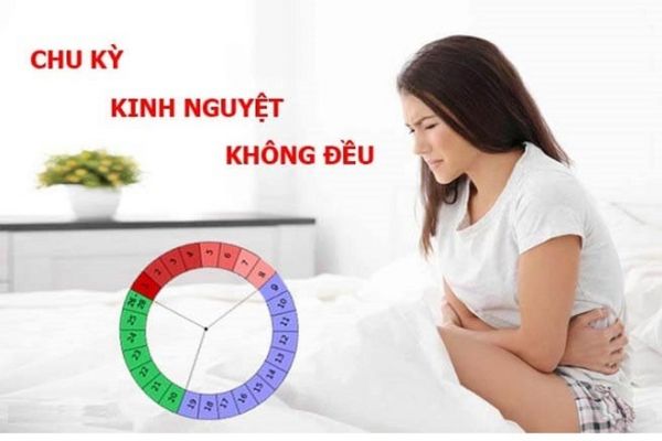 Kinh nguyệt không đều nguyên nhân và cách điều trị