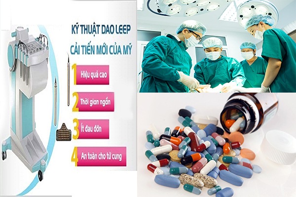Điều trị viêm loét tử cung như thế nào hiệu quả?