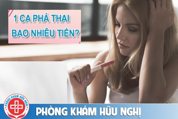 Chi phí nạo phá thai 2020 là bao nhiêu?