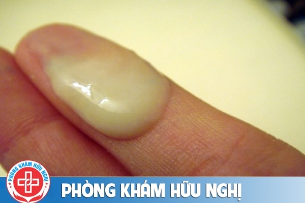 khi-hu-mau-nau-vang-do-dau