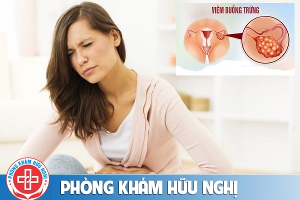 Viêm buồng trứng là gì có nguy hiểm không?