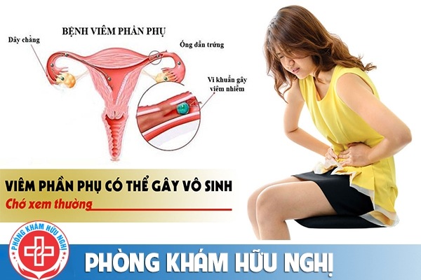 Chữa viêm phần phụ ở đâu hiệu quả?