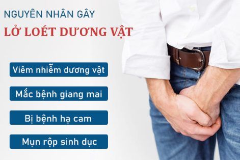 Địa chỉ khám dương vật uy tín tại Quy Nhơn