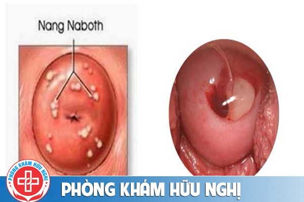 nang-naboth
