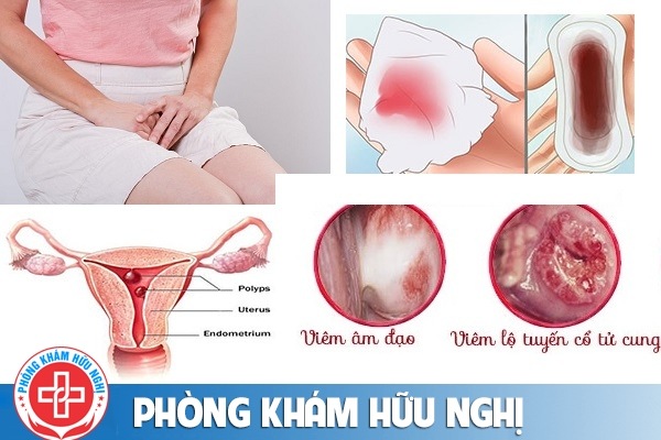 Ra máu vùng kín bất thường là bị bệnh gì?