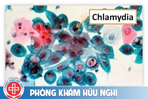 Bệnh chlamydia và những điều cần biết