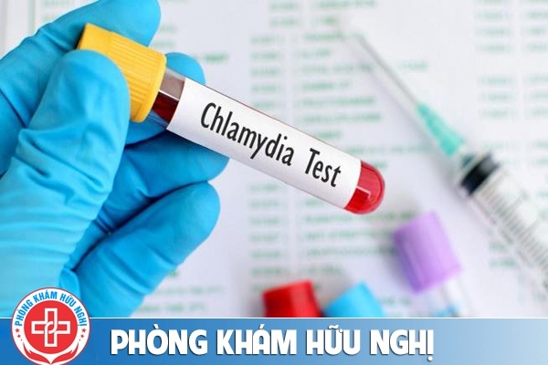 Xét nghiệm chlamydia ở đâu cho kết quả chính xác nhanh chóng?