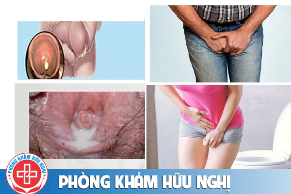 chay-mu-bo-phan-sinh-duc-la-gi