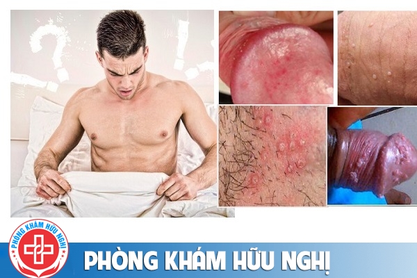 vung-kin-nam-noi-man-do