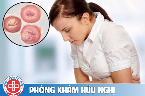Phương pháp nào điều trị viêm lộ tuyến cổ tử cung hiệu quả?