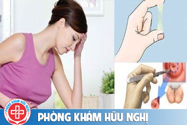 Dấu hiệu và cách điều trị viêm cổ tử cung