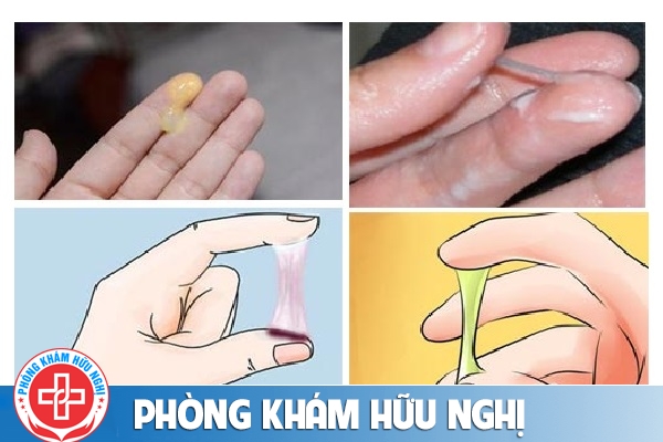 Nhận biết bệnh phụ khoa từ các biểu hiện bất thường ở khí hư nữ giới