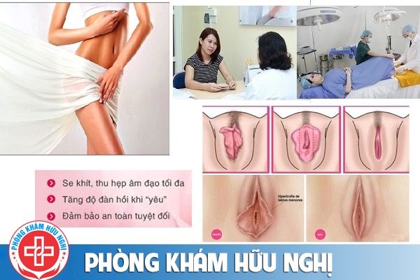 phong-kham-thu-hep-am-dao