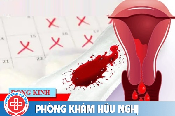 Phương pháp hỗ trợ cách chữa bệnh rong kinh ở nữ giới