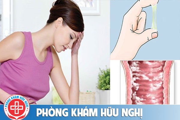 Tại sao lại bị viêm âm đạo – hậu quả của viêm âm đạo