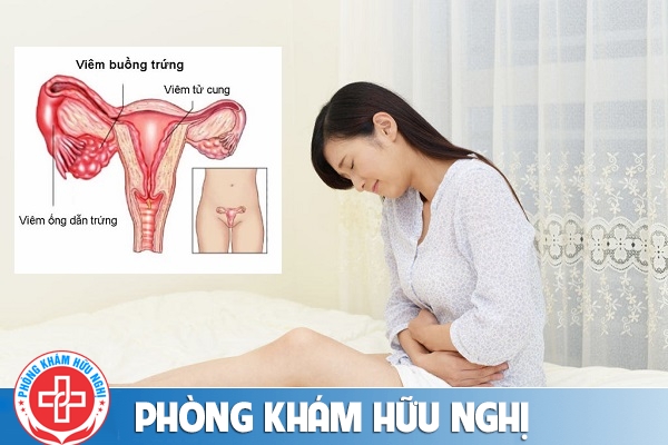 Thế nào là bệnh viêm buồng trứng?