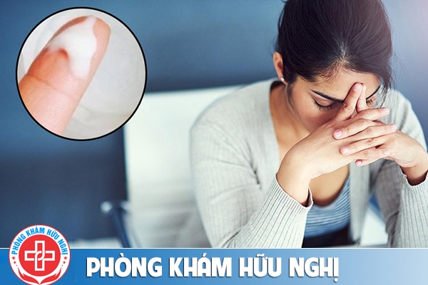Những hình ảnh biểu hiện nấm âm đạo