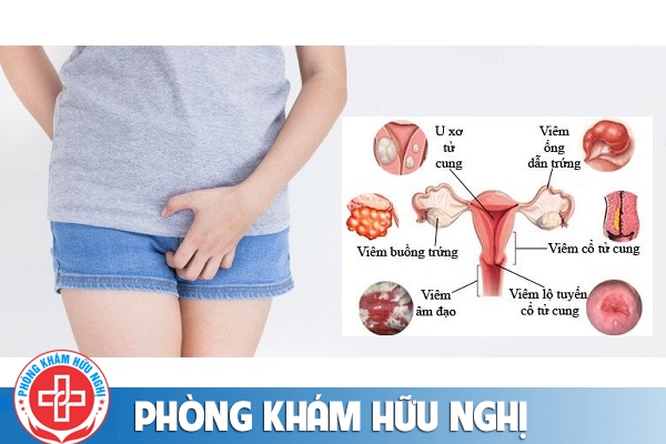 cac-trieu-chung-benh-phu-khoa