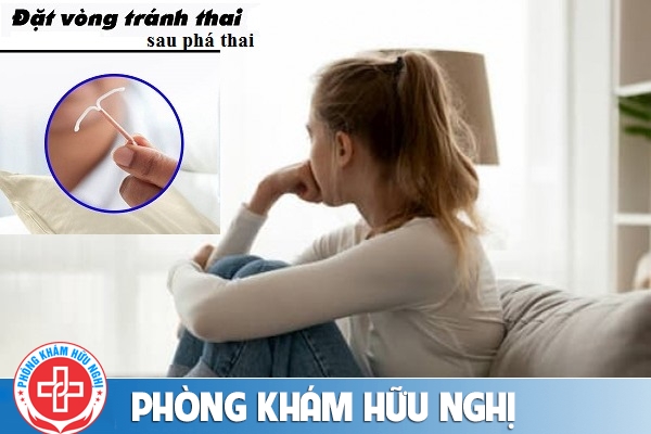 Đặt vòng tránh thai sau phá thai bao lâu thì an toàn?