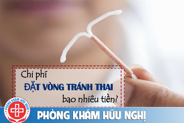Địa chỉ và chi phí đặt vòng tránh thai tốt