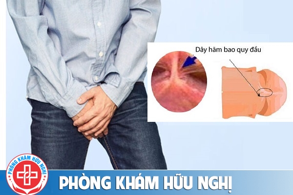 Đứt dây hãm dương vật nguy hiểm không?
