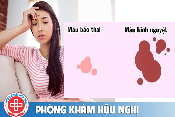 Cách nhận biết máu báo thai chính xác
