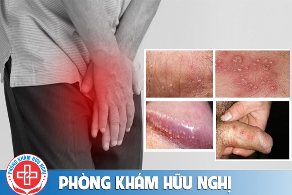 mun-duong-vat