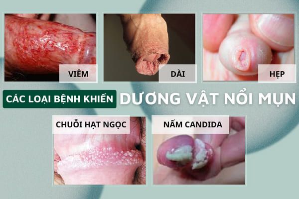 noi-mun-tren-duong-vat-la-bi-benh-gi-01