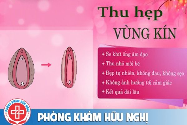 Có nên hơ than vùng kín sau sinh để làm đẹp?