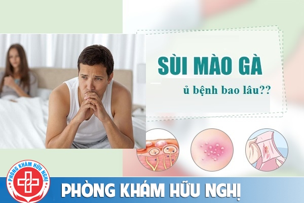 Thời gian ủ bệnh sùi mào gà bao lâu thì phát ra ngoài?