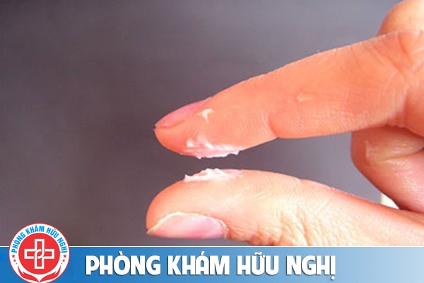 Vùng kín có mảng trắng là bị bệnh gì?