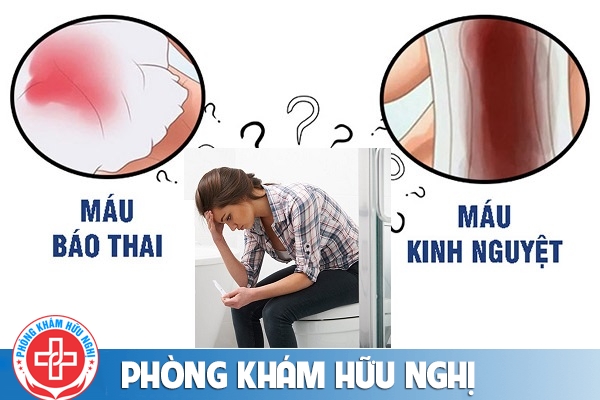 Cách phân biệt máu báo thai và máu kinh