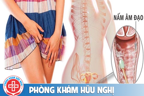 benh-vung-kin-nu