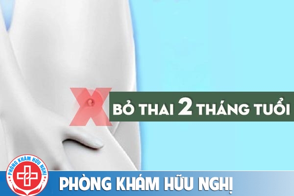 Bỏ thai 2 tháng tuổi bằng cách nào an toàn?