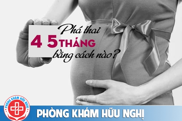Phá thai 4 5 tháng bằng cách nào an toàn?