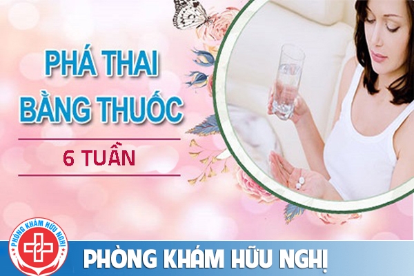 Phá thai bằng thuốc 6 tuần có được không?