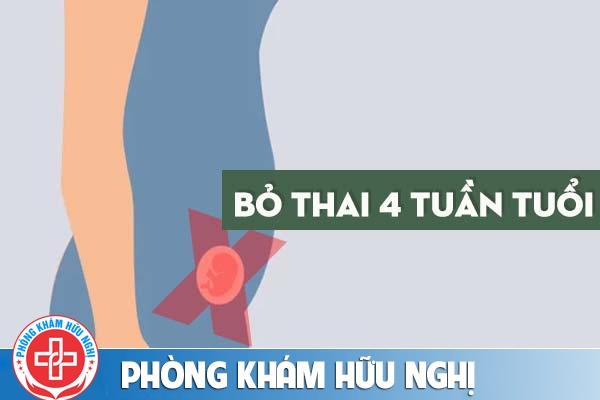 Thực hiện bỏ thai 4 tuần tuổi được không?