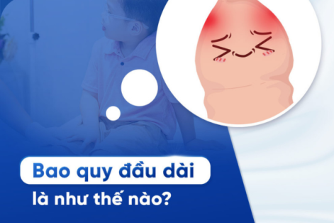 Đâu là biện pháp cắt dài bao quy đầu hiệu quả? 