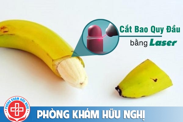 Cắt bao quy đầu bằng laser có an toàn không? quy trình như thế nào?