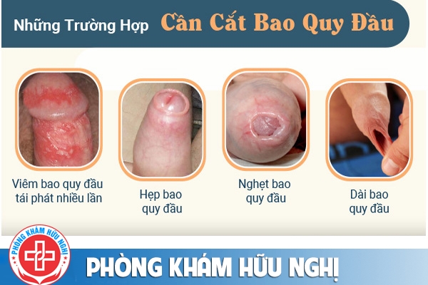 cat-bao-quy-dau-khi-nao