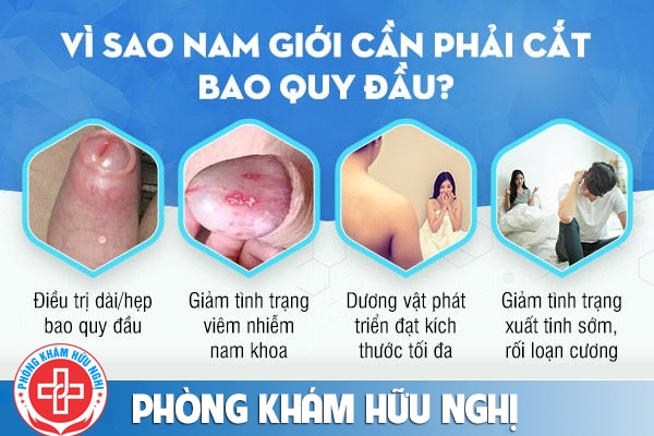 cat-bao-quy-dau-vi-sao-nam-gioi-can-thuc-hien-som-1