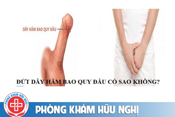 Đứt dây chằng dương vật nguyên nhân và cách điều trị
