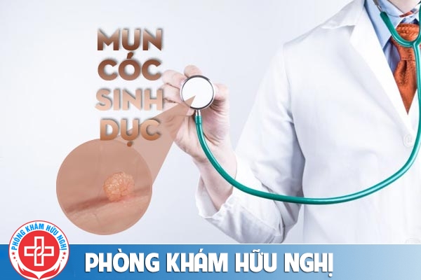 Điều cần biết về mụn cóc sinh dục