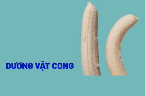 Dương vật cong phải làm sao?