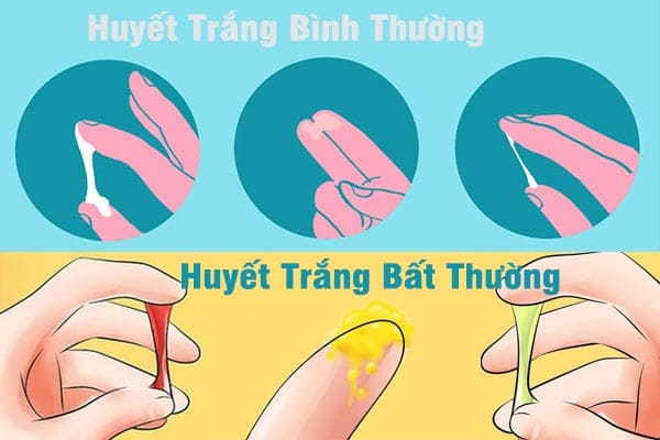 huyet-trang-nhung-luu-y-khong-nen-bo-qua-1